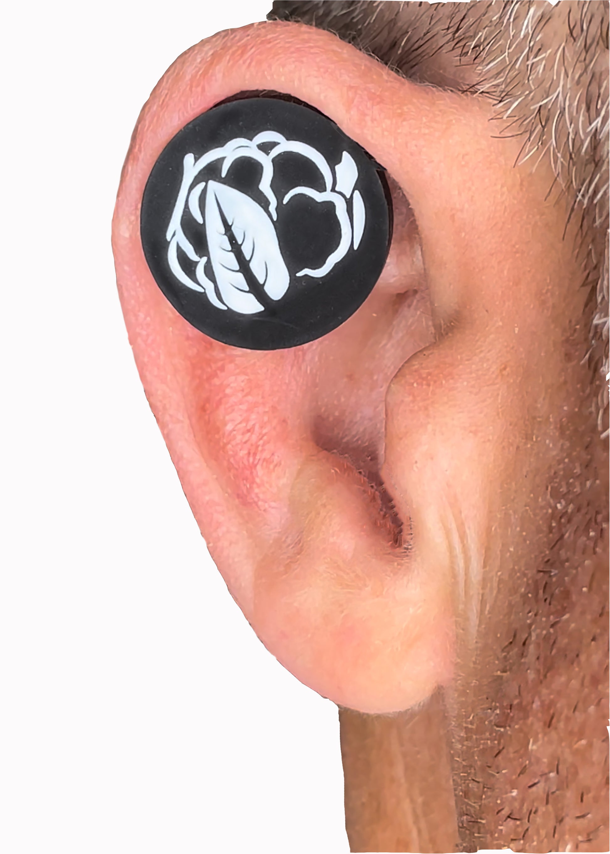 caulicooler cauliflower ear treatments magnets keloid compression cauli